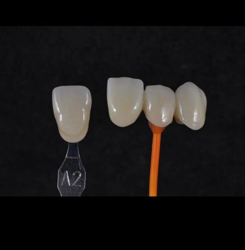 3D Pro Zirconia Dental White CAD CAM Block 98/95/92mm Ανοιχτό Σύστημα CE